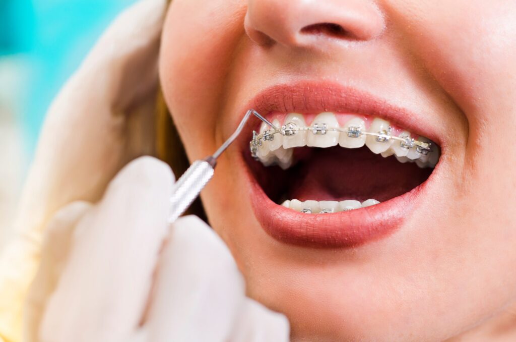 adult getting braces checked by dentsit scaled