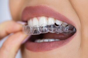 istock 1429256190 e 1024x683