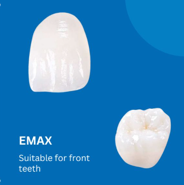 E- max Crowns