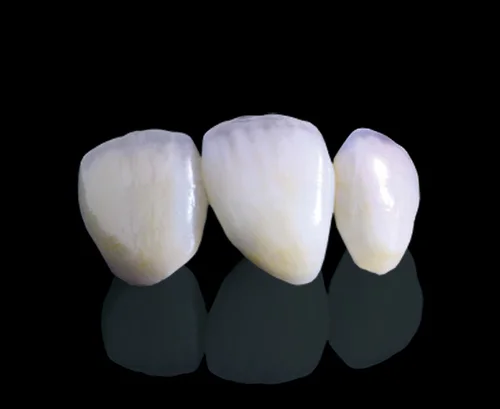 E- max Crowns