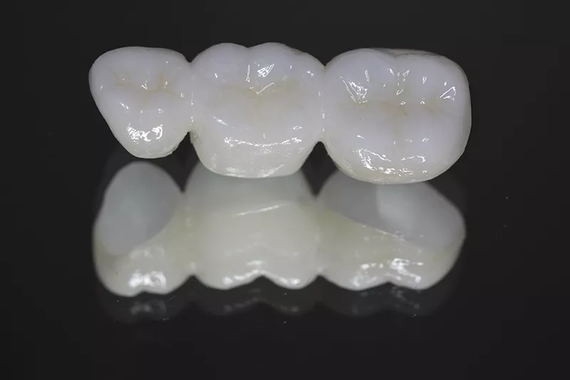 All Ceramic / Zirconia Bridges
